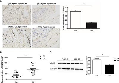 Additive Effects of VDBP and 1,25(OH)2D3 on the Viability and Apoptosis of Rheumatoid Arthritis Synovial Fibroblasts